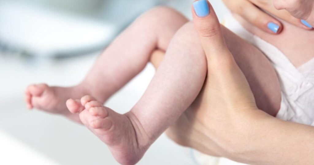 Tragédia em SC: Bebê de 6 Meses Perde a Vida por Meningite Bacteriana